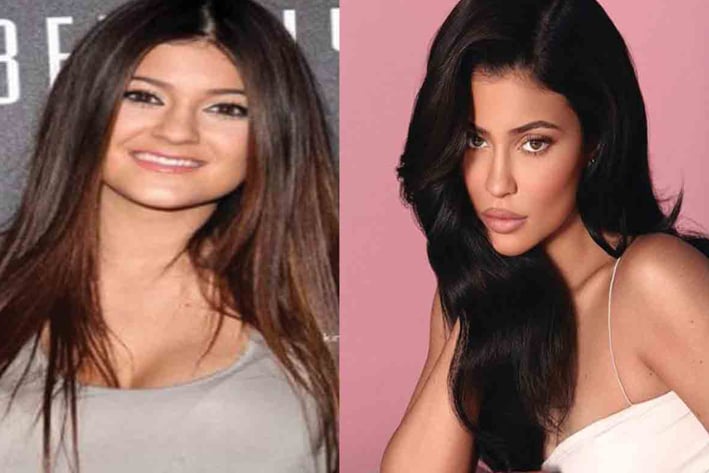 Kylie Jenner reitera que nunca se ha operado la cara