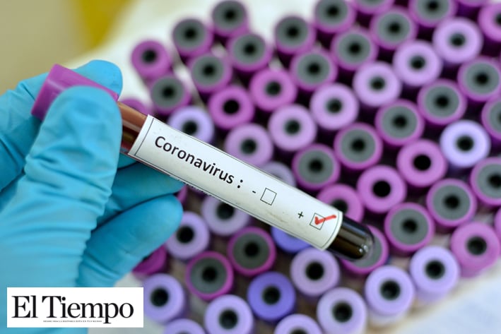 Vacuna contra coronavirus lista en 18 meses