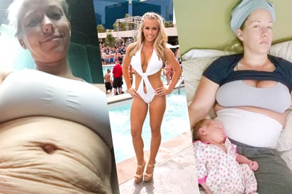 Kendra Wilkinson, ex Playboy, muestra con orgullo sus estrías post mamá