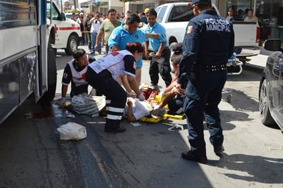 Amputa colectivo piernas a ancianita, fallece en hospital