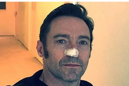 Hugh Jackman de nueva cuenta recibe tratamiento contra cáncer