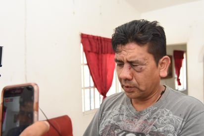 Golpean a activista del PAN