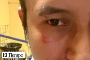 Golpean Policías a Reportero