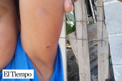 Ataca Pitbull a niño de 3 años