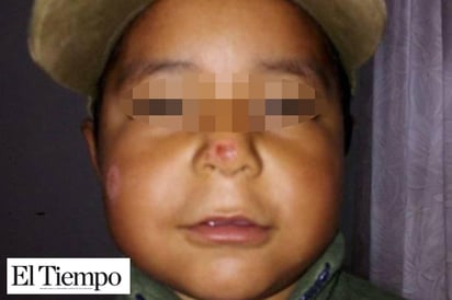 Tortura madre drogadicta a su hijo y le quema la cara