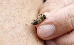 ¿Qué hacer cuando te pica una abeja? UNAM explica