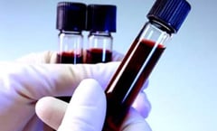 Gobierno británico comenzará a indemnizar este año a víctimas del escándalo de sangre contaminada