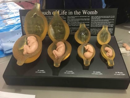 'Voces por la Vida' 40 días orando a favor de la vida en el vientre