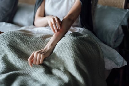 Síntomas y cómo reconocer la urticaria por frío