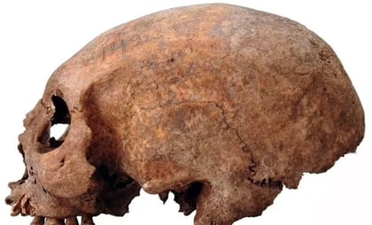 Estudio sugiere que los vikingos ya hacían cirugías plásticas: 'alargaban cráneos'