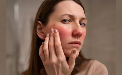 Por qué se hincha la cara: causas y posibles enfermedades