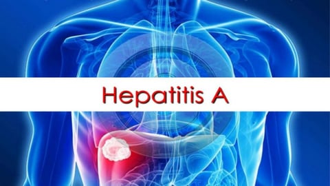 Coahuila primer lugar en hepatitis A