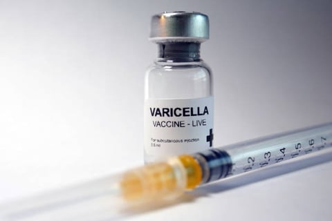 Los casos de varicela aumentaron en un 31 por ciento en Coahuila