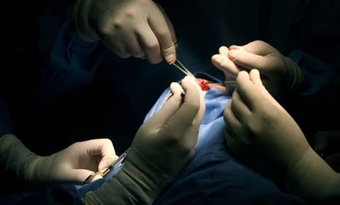 Fallece paciente que recibió primer trasplante de riñón de cerdo modificado genéticamente