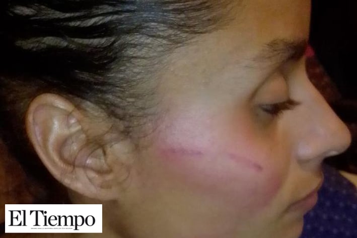 Agresiva empleada de bibliotecas  golpea en la cara a una ciudadana