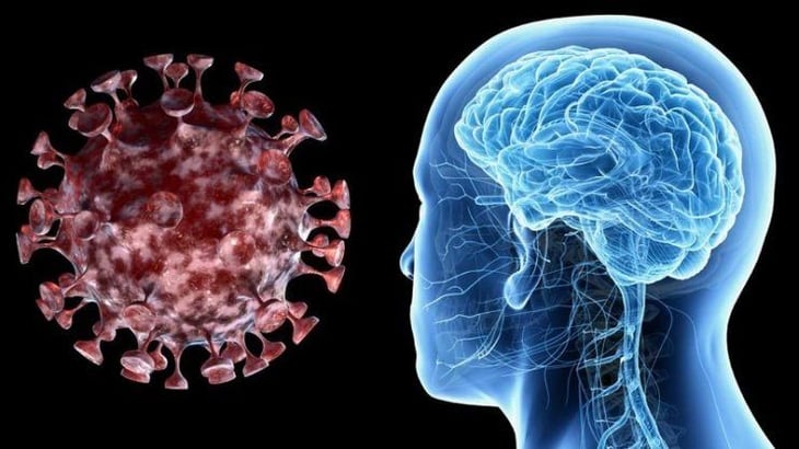 Pacientes de COVID-19 podrían sufrir afectaciones cerebrales