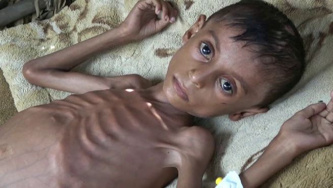 El riesgo de una hambruna vuelve al Yemen, según la ONU