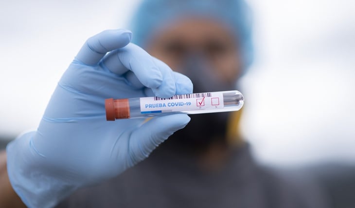 Francia registra 10,489 casos y 65 muertes por coronavirus en un día