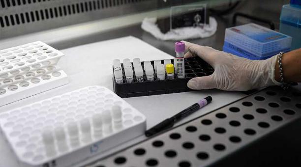 Primer kit de diagnóstico PCR ecuatoriano sale al mercado