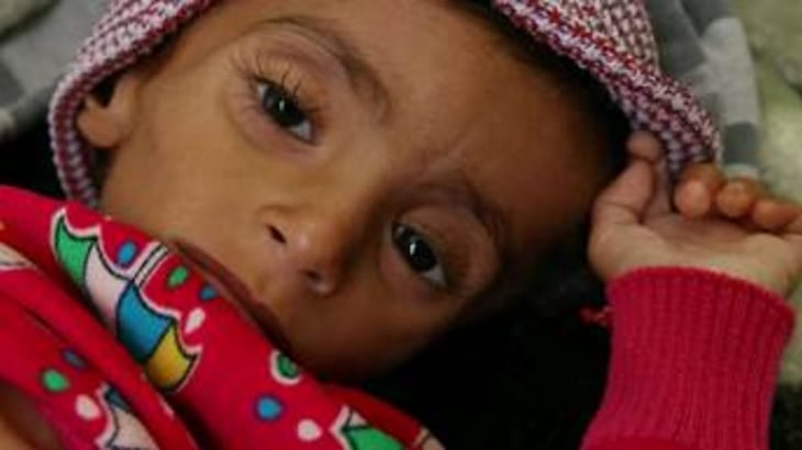 Yemen está al borde de la peor hambruna vista en décadas, según la ONU