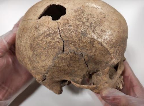 En España descubren un homicidio que sucedio hace 5.000 años