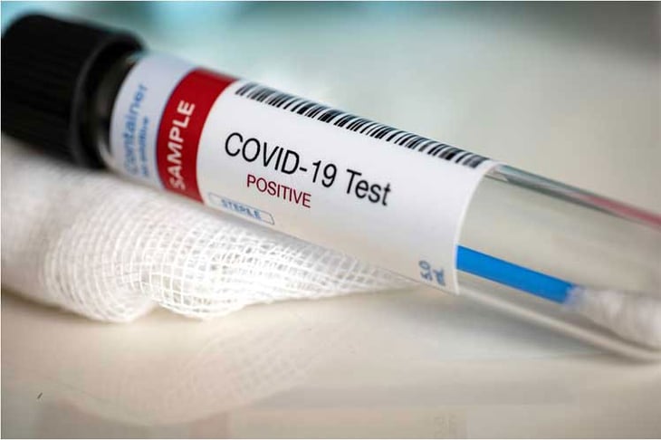 Costa Rica detecta ocho casos probables de reinfección por COVID-19