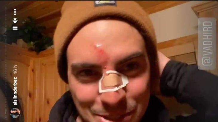 Al esquiar Vadhir Derbez  cayó y se lesionó la cara