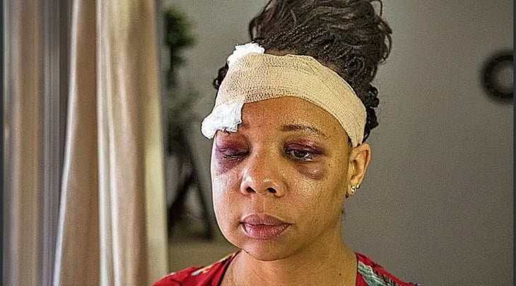 Exculpan a policía que disparó 'balas de goma' al rostro de una mujer en EU