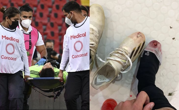 Las lesiones que dejó el Preolímpico a futbolistas mexicanos