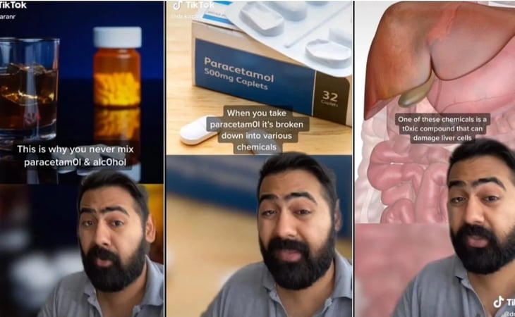 Médico explica el daño que hace el paracetamol en la cruda