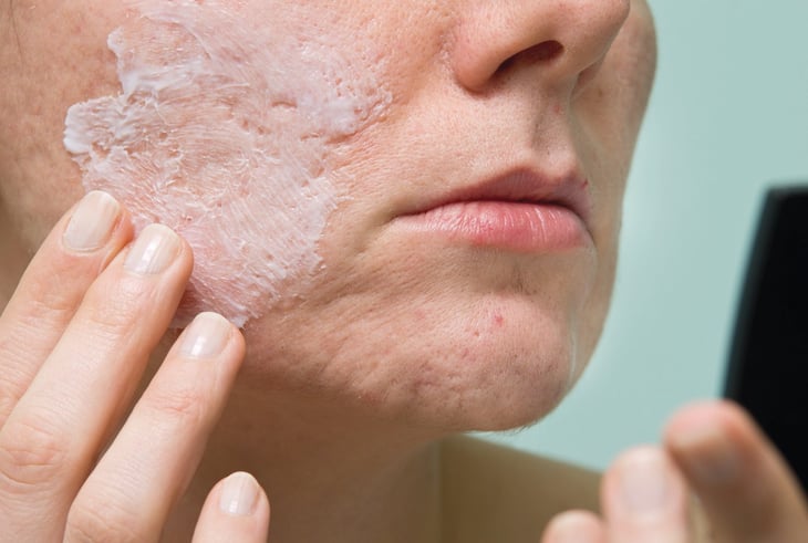 5 formas de usar la vitacilina para la piel