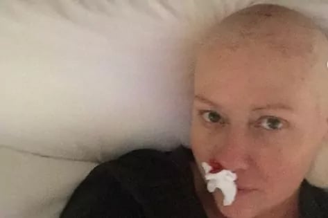 Shannen Doherty comparte las imágenes más duras de su lucha contra el cáncer