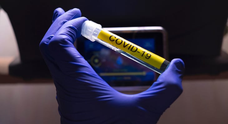 Venezuela supera los 439,000 casos de COVID-19 desde el inicio de la pandemia