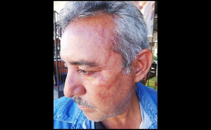 Investigan a policías municipales por golpear a reportero en Los Cabos