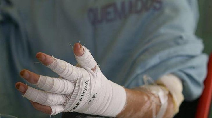 Al menos 409 lesionados por pólvora durante la temporada navideña en Colombia