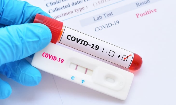 Argentina aprueba los autotesteos de COVID-19 debido al incremento de casos