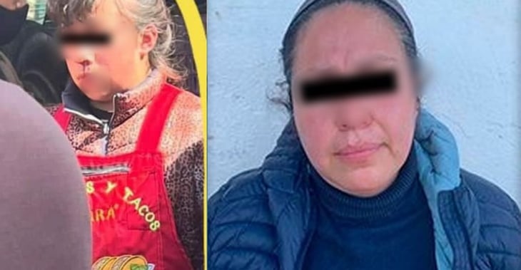 Mujer le rompe la nariz a niña de 12 años por mirar a su esposo