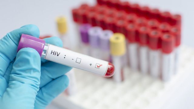 Casos de VIH siguen en investigación, ya que se pueden registrar más