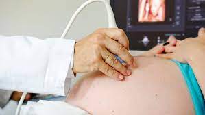 16 abortos se han realizado durante marzo en el Hospital Amparo Pape de Monclova 