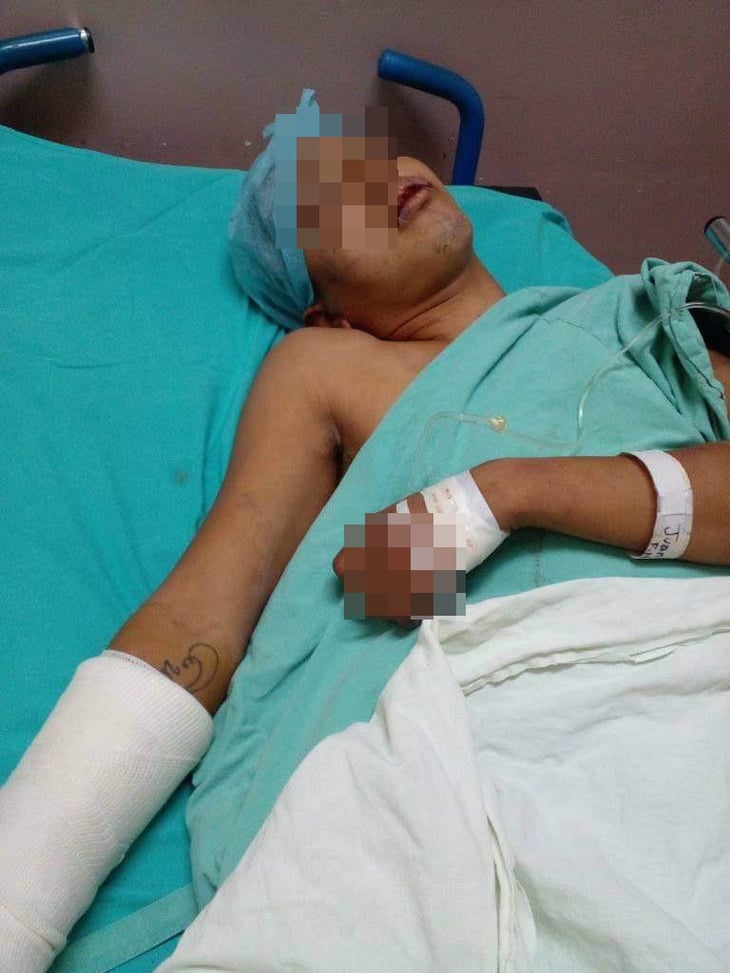 Joven es macheteado por ladrones en Monclova