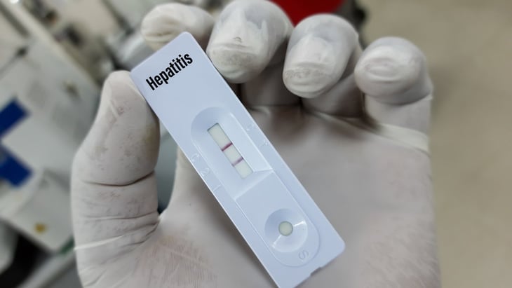 Argentina investiga 8 casos sospechosos de hepatitis de origen desconocido