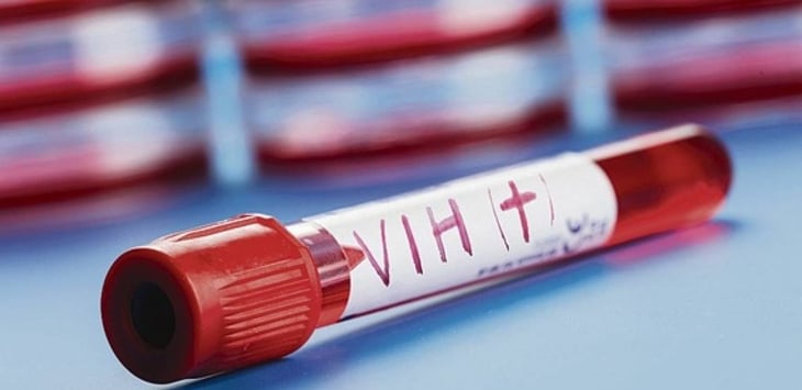70 % de mujeres con VIH son contagiadas por su pareja en Monclova 