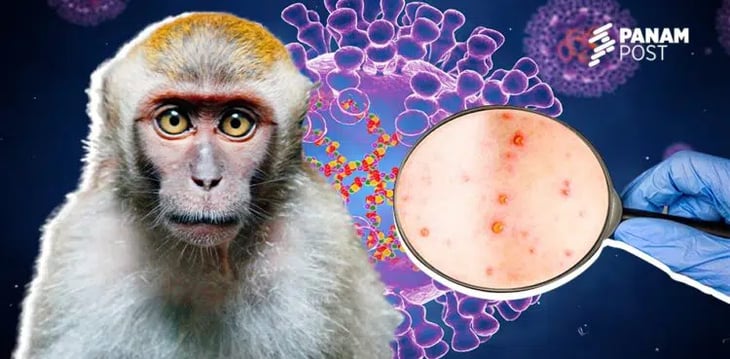 La OMS reporta más de 1,000 casos de viruela del mono fuera de África donde se propagó