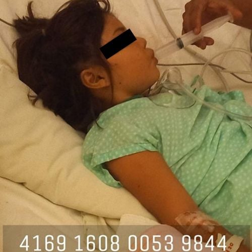 Aylani niña que cayó de un segundo piso en Monclova se recupera  con grandes avances    