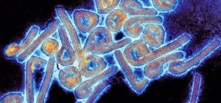 ¿Cuál es mortal virus de Marburgo?, síntomas y causas