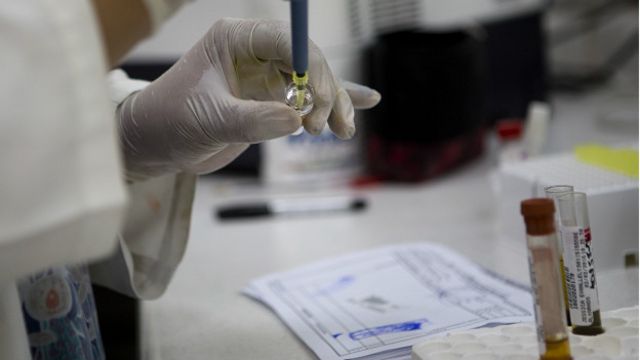 60 pruebas trioplex para detectar el dengue en Monclova