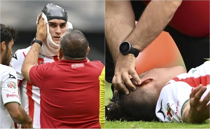 La horrible herida en la cabeza de Alexis Peña jugador de Necaxa