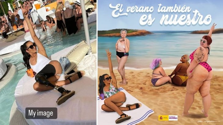 Modelo con prótesis exhibe a Gobierno español por cartel equivocado