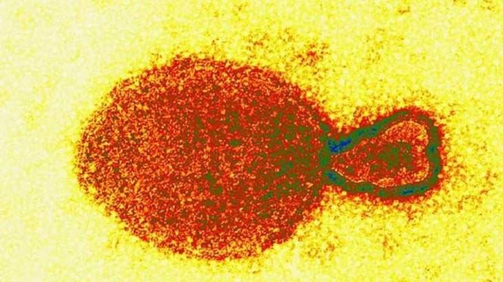 Nuevo virus detectado en China: hay 35 contagios