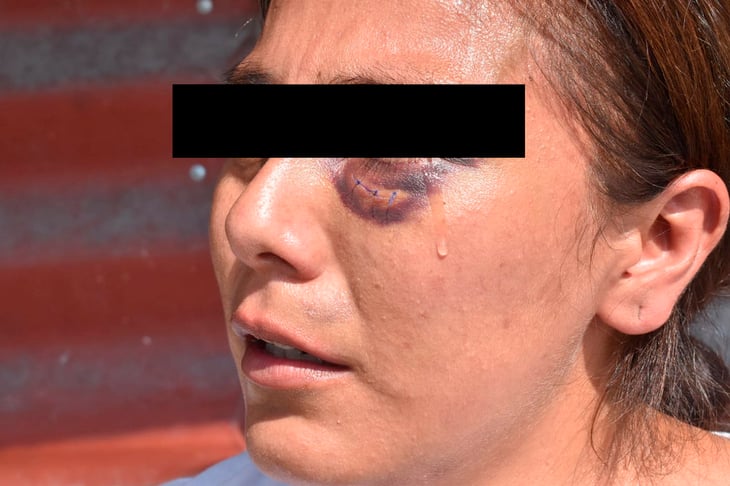 Mujer denuncia a su hermano por golpiza y familia la echa a la calle